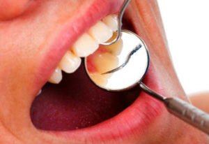 PDM_Oral-Cancer-Screening15